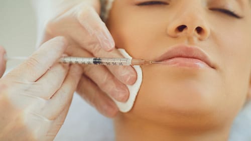 Melasma & Pigmentation by morningsun