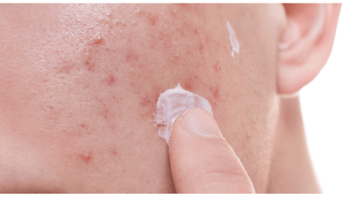 dermatology treatments