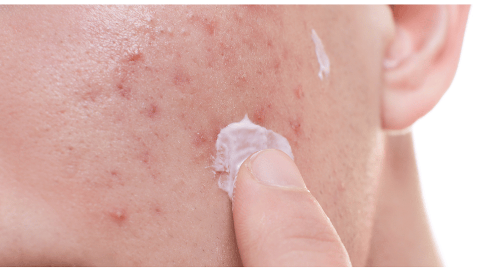 Skin Allergies by morningsun