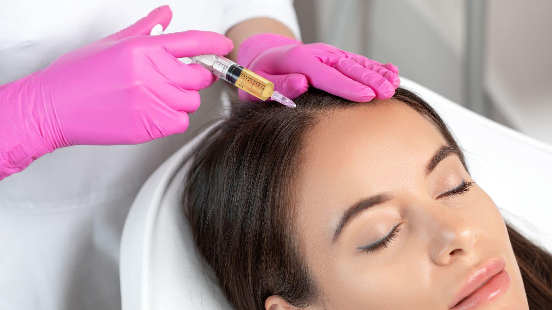 PRP Hair Treatment by morningsun